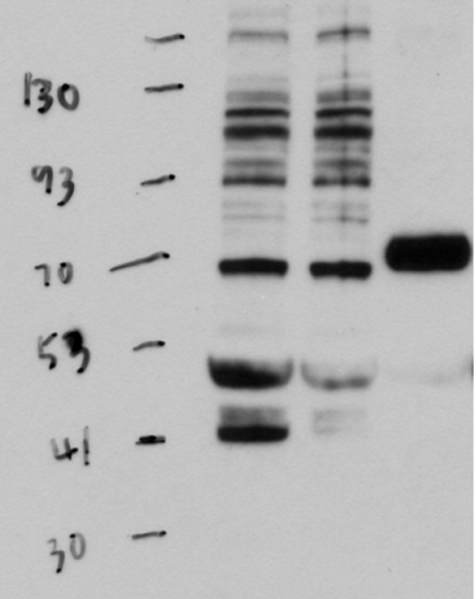 Western blot using anti-TGA1 antibodies